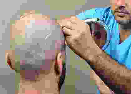 hair-rx